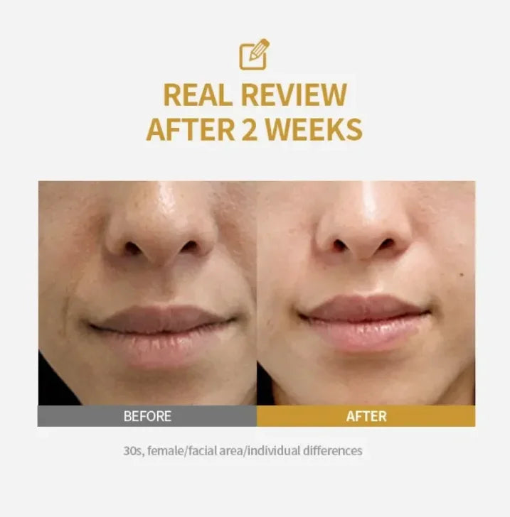 2026+ Dullness in One Serum Kojic Acid + Niacinamide – The Brightening Duo That Fades Dark Spots, Acne Scars, Melasma,